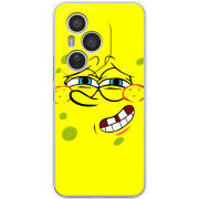 Чохол BoxFace Honor 400 Pro 