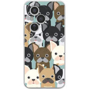 Чохол BoxFace Honor 400 Pro 