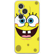 Чохол BoxFace Honor 400 Pro 