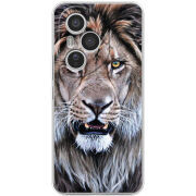 Чохол BoxFace Honor 400 Pro 