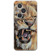 Чохол BoxFace Honor 400 Pro 