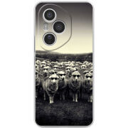 Чохол BoxFace Honor 400 Pro 