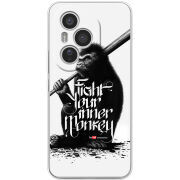 Чохол BoxFace Honor 400 Pro 