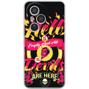 Чохол BoxFace Honor 400 Pro 