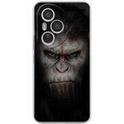 Чохол BoxFace Honor 400 Pro 