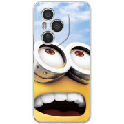 Чохол BoxFace Honor 400 Pro 