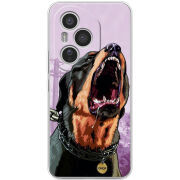 Чохол BoxFace Honor 400 Pro 