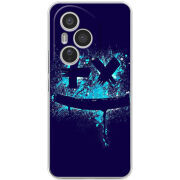 Чохол BoxFace Honor 400 Pro 