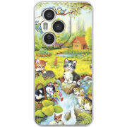 Чохол BoxFace Honor 400 Pro 