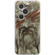 Чохол BoxFace Honor 400 Pro 