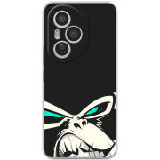 Чохол BoxFace Honor 400 Pro 