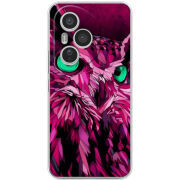 Чохол BoxFace Honor 400 Pro 