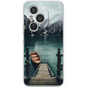 Чохол BoxFace Honor 400 Pro 