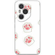 Чохол BoxFace Honor 400 Pro 