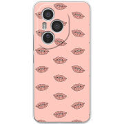 Чохол BoxFace Honor 400 Pro 