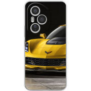 Чохол BoxFace Honor 400 Pro Corvette Z06