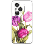 Чохол BoxFace Honor 400 Pro 