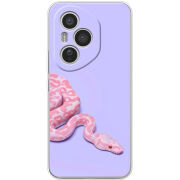 Чохол BoxFace Honor 400 Pro 