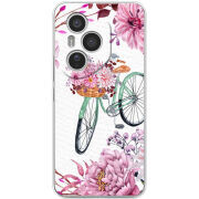 Чохол BoxFace Honor 400 Pro 