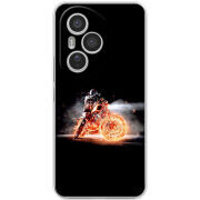 Чохол BoxFace Honor 400 Pro 