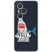 Чохол BoxFace Honor 400 Pro 