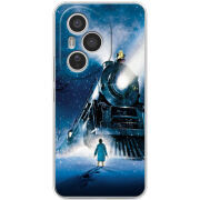 Чохол BoxFace Honor 400 Pro 