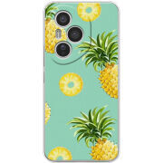 Чохол BoxFace Honor 400 Pro 