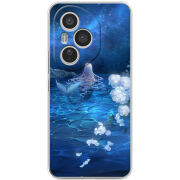 Чохол BoxFace Honor 400 Pro 