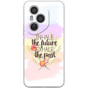 Чохол BoxFace Honor 400 Pro 