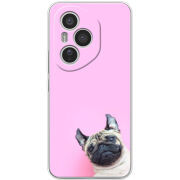 Чохол BoxFace Honor 400 Pro 