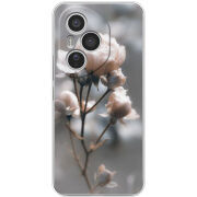 Чохол BoxFace Honor 400 Pro 