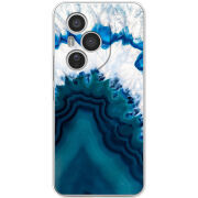 Чохол BoxFace Honor 400 Pro 