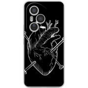 Чохол BoxFace Honor 400 Pro 