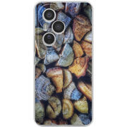 Чохол BoxFace Honor 400 Pro 