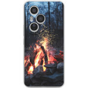 Чохол BoxFace Honor 400 Pro 