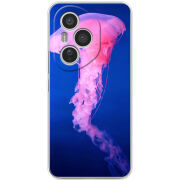 Чохол BoxFace Honor 400 Pro 