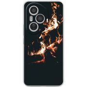 Чохол BoxFace Honor 400 Pro 