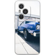 Чохол BoxFace Honor 400 Pro 