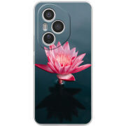 Чохол BoxFace Honor 400 Pro 