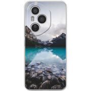 Чохол BoxFace Honor 400 Pro 