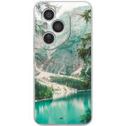 Чохол BoxFace Honor 400 Pro 