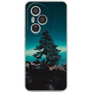 Чохол BoxFace Honor 400 Pro 