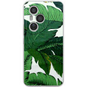 Чохол BoxFace Honor 400 Pro 