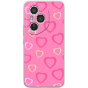 Чохол BoxFace Honor 400 Pro Sugar Hearts