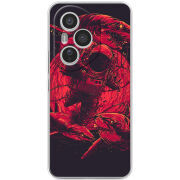 Чохол BoxFace Honor 400 Pro 