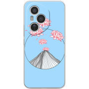 Чохол BoxFace Honor 400 Pro 