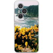 Чохол BoxFace Honor 400 Pro 