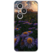 Чохол BoxFace Honor 400 Pro 