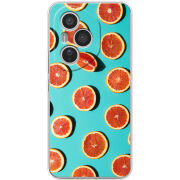 Чохол BoxFace Honor 400 Pro 