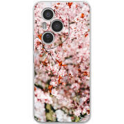 Чохол BoxFace Honor 400 Pro 